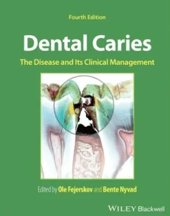 Dental Caries