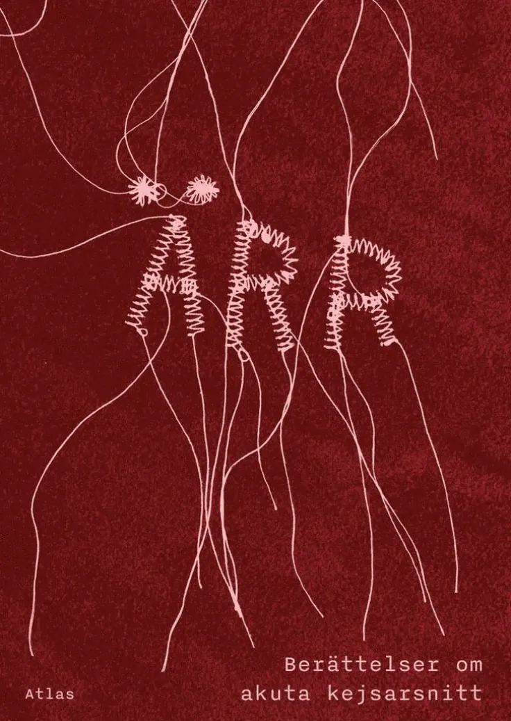 Ärr : berättelser om akuta kejsarsnitt