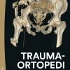 Traumaortopedi