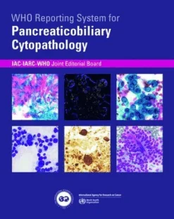 WHO reporting system for Pancreaticobiliary Cytopathology