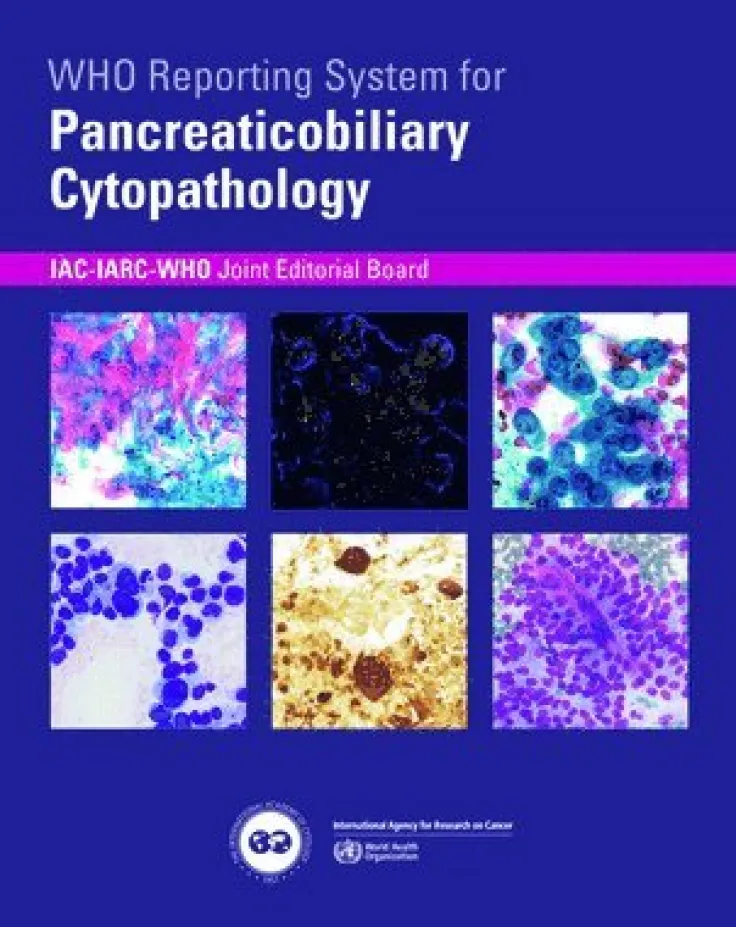 WHO reporting system for Pancreaticobiliary Cytopathology